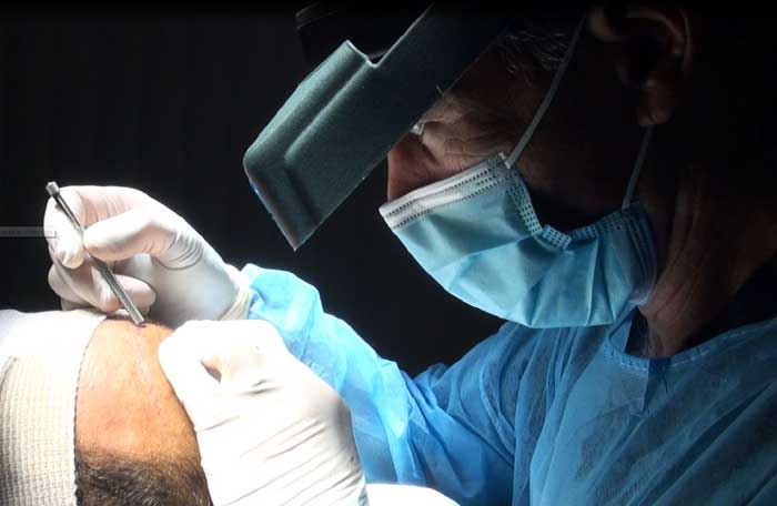 Dr. Boden performing hair transplant surgery.